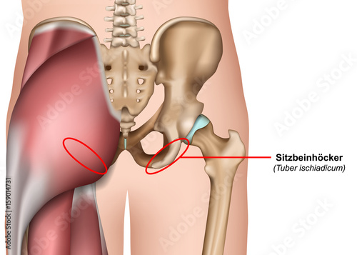 Anatomie der Hüfte, Sitzbein, Sitzbeinhöcker photo