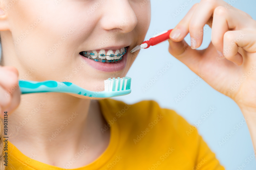Woman smiling cleaning teeth with braces Woman smiling cleaning teeth with braces