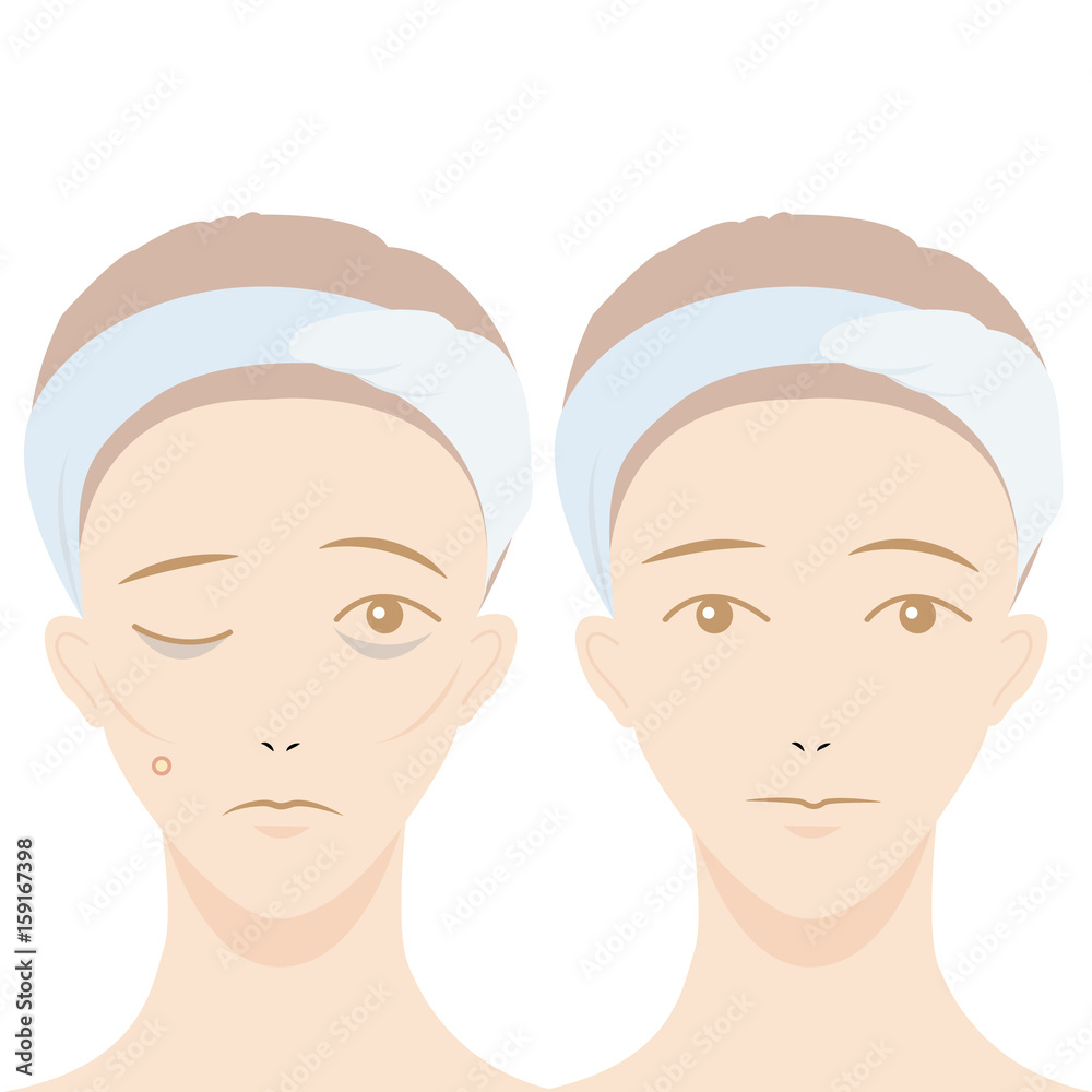 Skin care After use, Before use, Beautiful woman face.