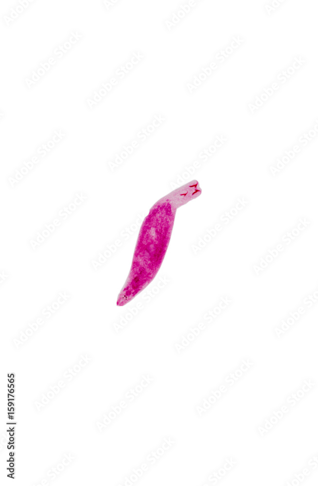 Trianchoratus sp.on slide under microscope view. Trianchoratus sp.on slide under microscope view.