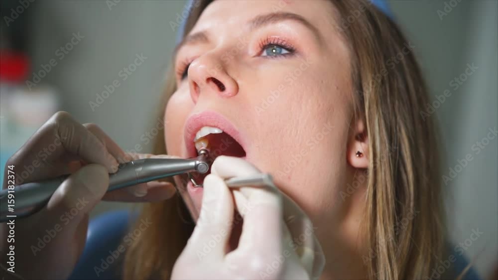 Close up shot of the women's mouth, who produce cosmetic cleansing of the oral cavity in the dental office. Doctor in latex gloves removes plaque from teeth Close up shot of the women's mouth, who produce cosmetic cleansing of the oral cavity in the dental office. Doctor in latex gloves removes plaque from teeth