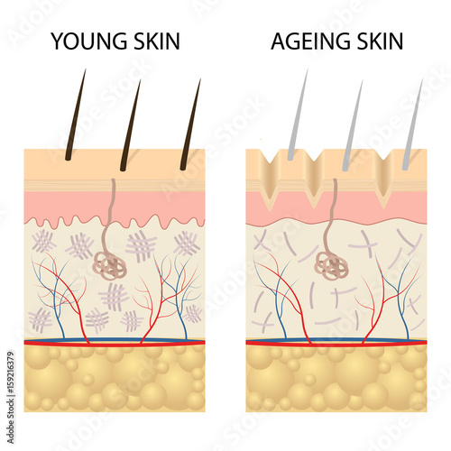 Young healthy skin and older skin comparison.