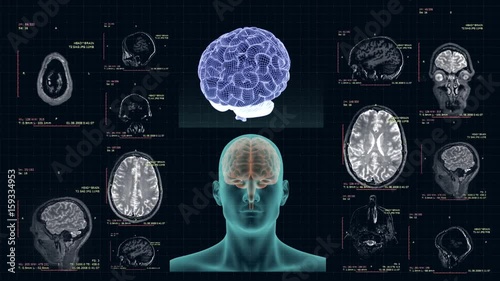 MRI of the human brain in different projections, high-tech concept