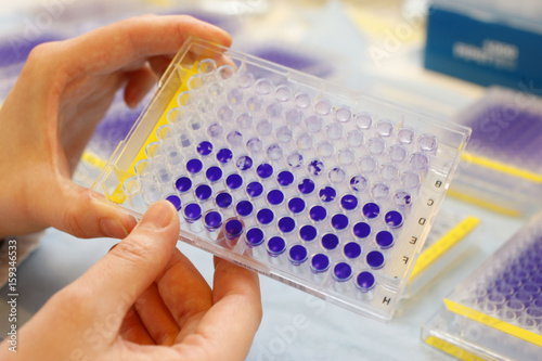 AIDS, RESEARCH photo
