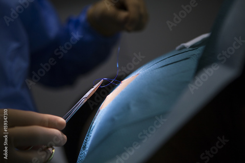DERMATOLOGIC SURGERY
