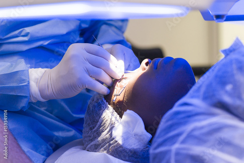 EYE LASER SURGERY