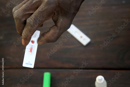 Rapid test for malaria, togo. photo