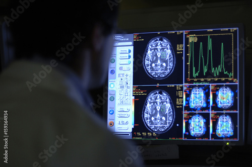 Radiologist examining the brain MRI scans on the computer monitor