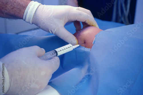 KNEE, INFILTRATION