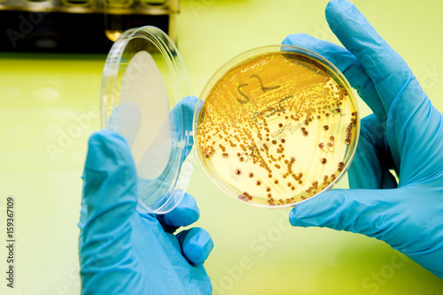 ESCHERICHIA COLI