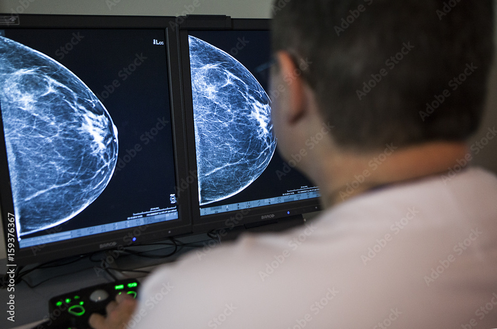 MAMMOGRAPHY EXAMINATION Stock Photo | Adobe Stock