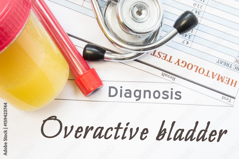 Overactive Bladder diagnosis. Container with urine sample, tube with