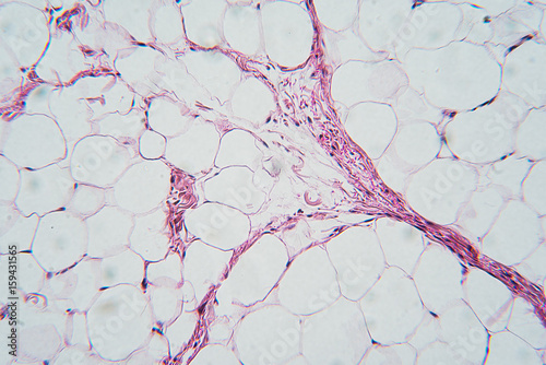 Breast tissue section, microscopic image photo