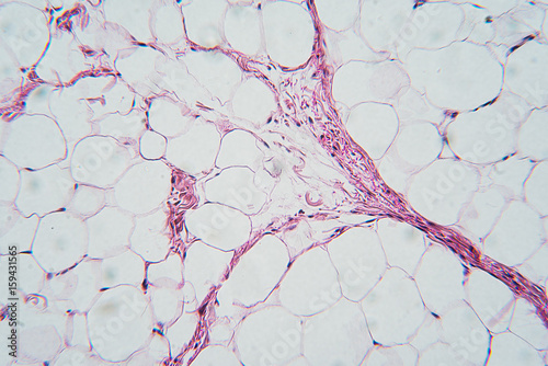 Breast tissue section, microscopic image