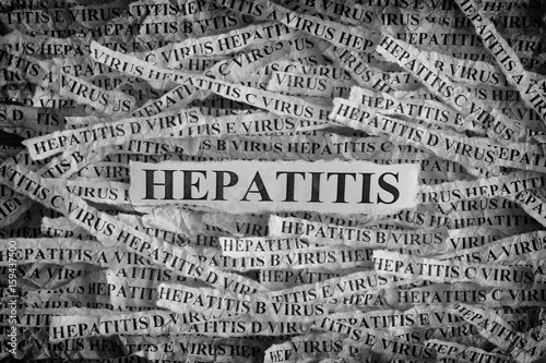 Torn pieces of paper with the words Hepatitis