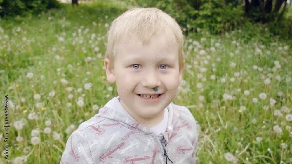 Portrait of beautiful expressive boy with a sore under his nose, smeared with green paint. Charming child involuntarily making faces at the camera in a funny way Portrait of beautiful expressive boy with a sore under his nose, smeared with green paint. Charming child involuntarily making faces at the camera in a funny way