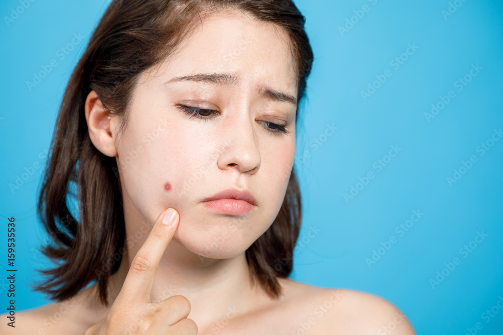 young woman who checks her skin. acne treatment. young woman who checks her skin. acne treatment.