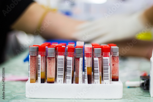 Fototapeta Naklejka Na Ścianę i Meble -  Blurred Physical examination - Nurse doing Blood sampling with syringe and needle for analysis