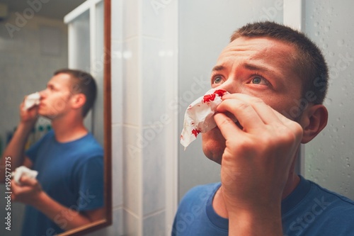 Man with nose bleed photo