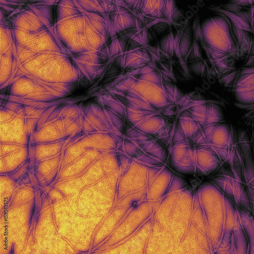 Electron microscope image, prion protein fibrils photo