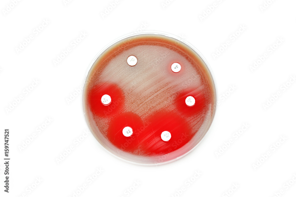 Fototapeta premium Antimicrobial susceptibility testing in petri dish 