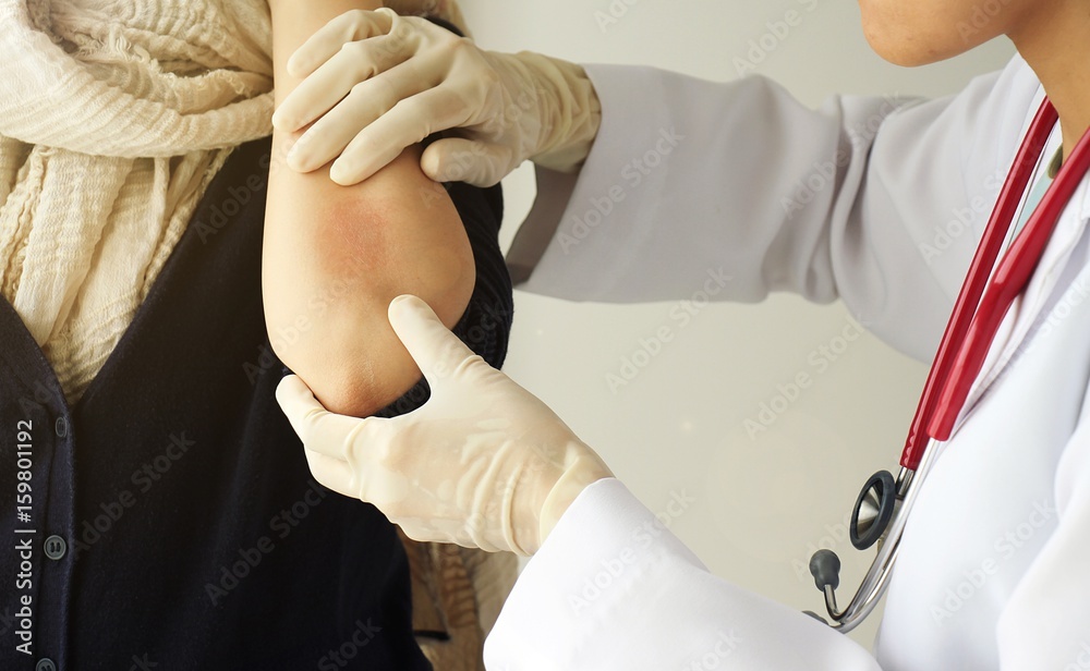Dermatologist doctor doing treatment, Female patient with allergic rash dermatitis eczema skin, Skin diseases