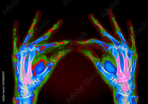 hands tomography simulation
 photo