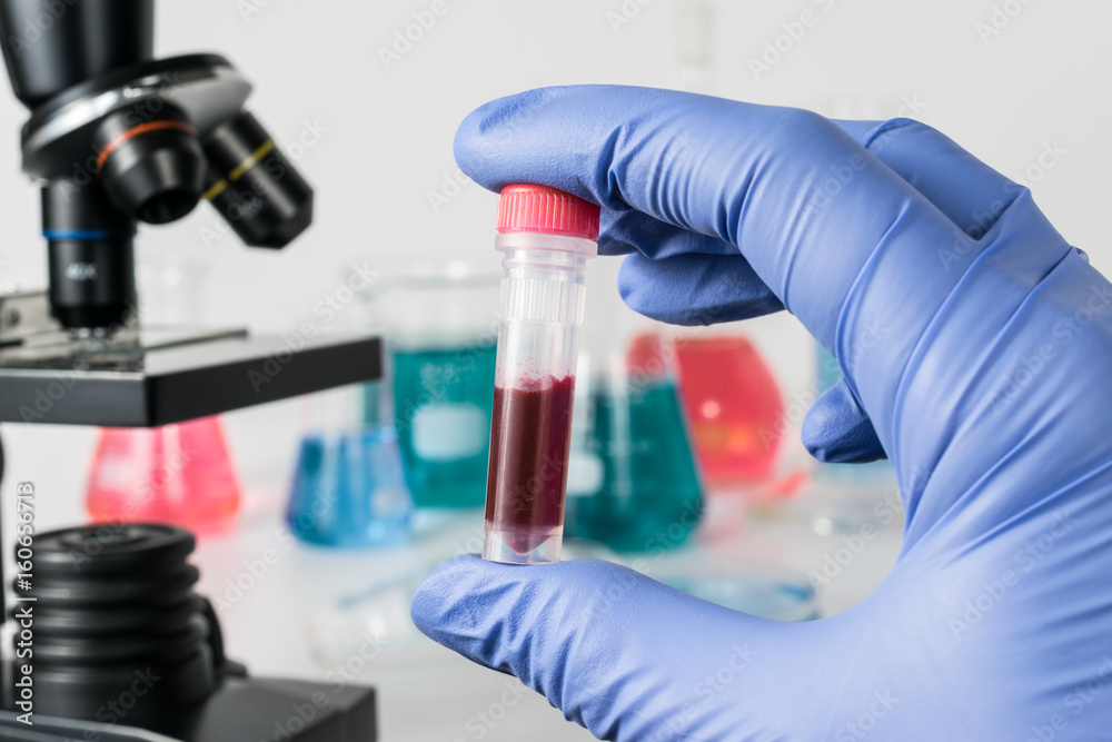 Fototapeta premium Scientist with blood sample. Medical laboratory.