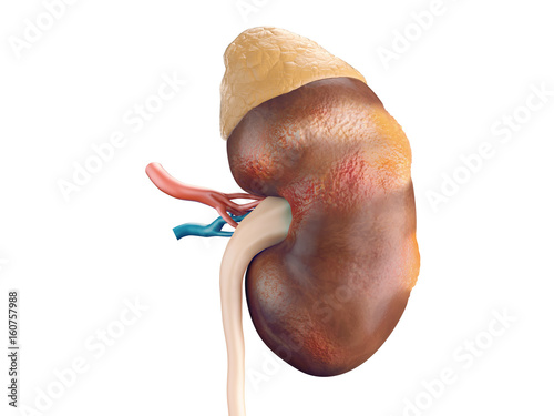 Human kidney cancer