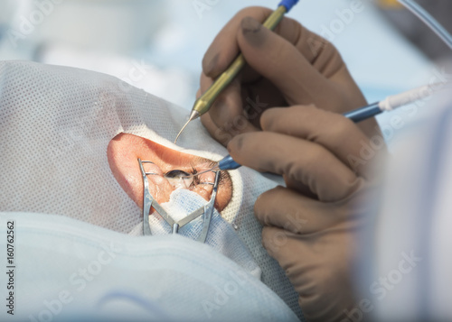 Phacoemulsification, destruction of the opaque lens of the eye by ultrasound.