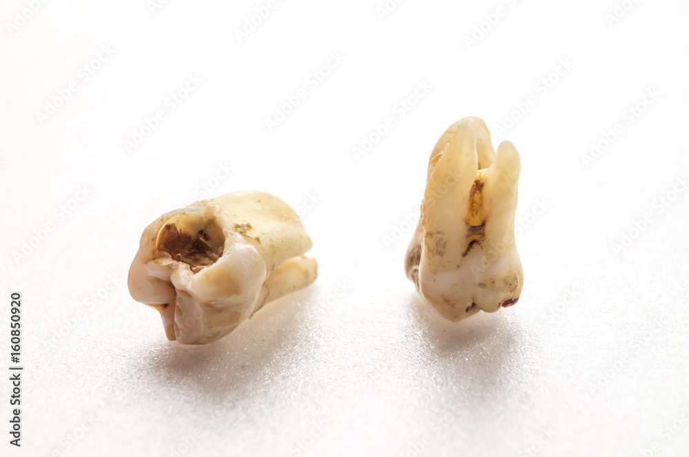 Two bad teeth - Oral dental hygiene Two bad teeth - Oral dental hygiene