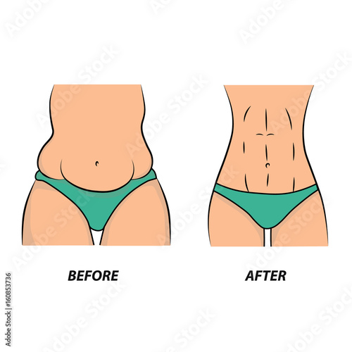 Thick and thin, overweight problems concept. Part of female torso with fat and lean abdomen and hips. Tummy before and after diet, fitness or liposuction. Vector illustration.