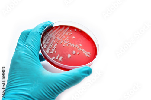 Colonies of bacteria in petri dish (blood agar)
 photo