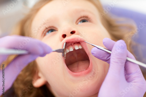 Dentist treating little girl