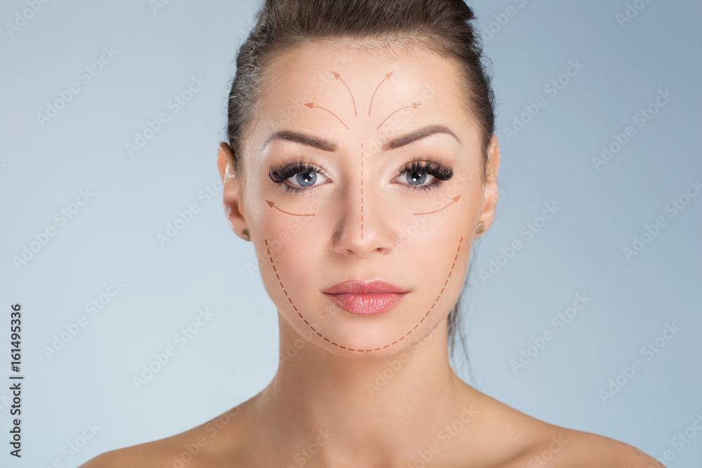 Young pretty woman with surgical markers on face Young pretty woman with surgical markers on face
