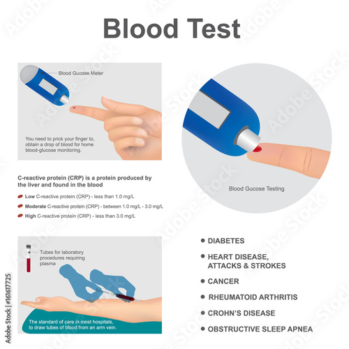 Blood test laboratory analysis. Illustration graphic vector.