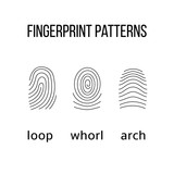 Three fingerprint types on white background.