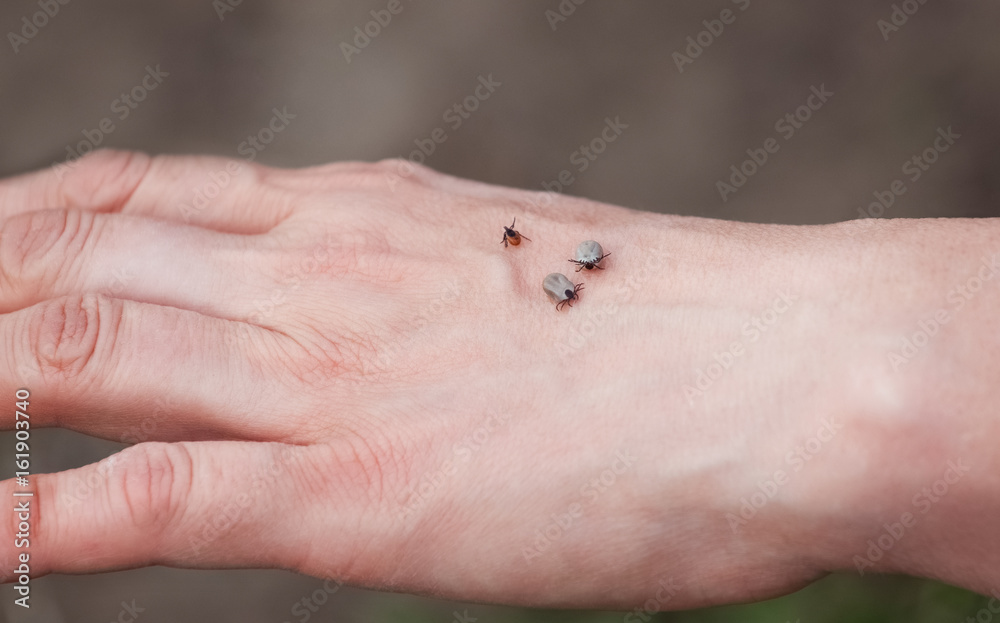 Three ticks sit on a man's hand in nature.