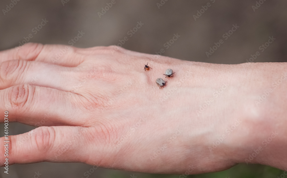 Three ticks sit on a man's hand in nature. Three ticks sit on a man's hand in nature.
