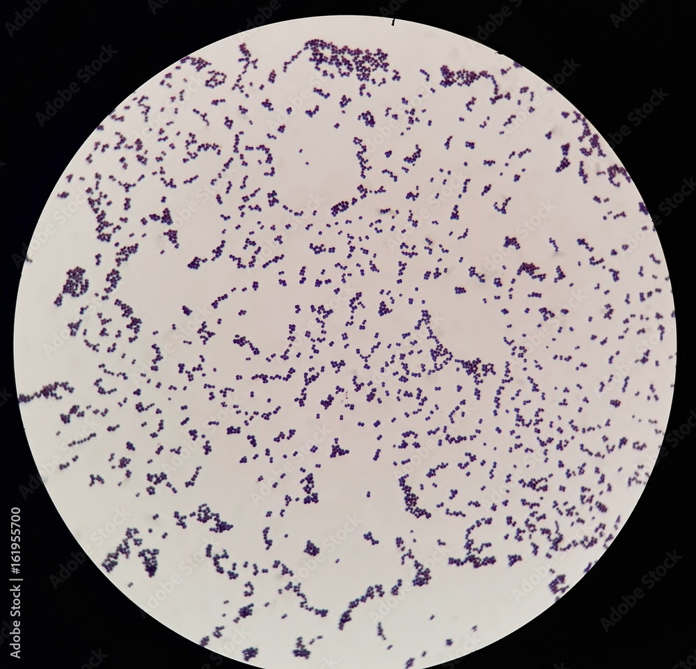 Smear of gram positive cocci bacteria under 100X light Stock Photo | Adobe Stock
