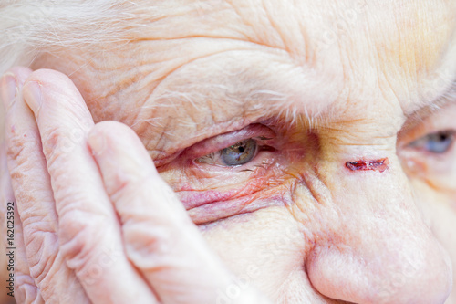 Konstfotografi Injured elderly woman's eyes & face