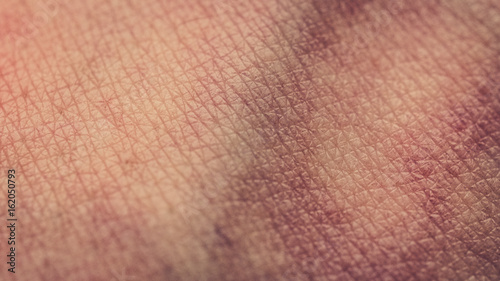 closeup of human skin, bruises, veins, skin texture