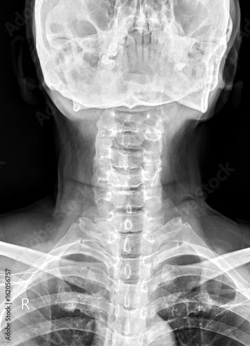 x-ray of human neck