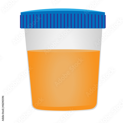 Urinalysis. Medical examination.