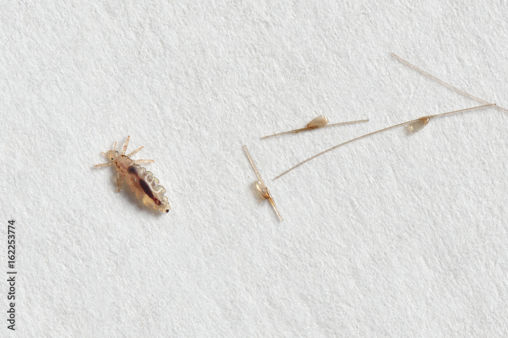 Louse and nits cocoons on white paper background Stock Photo Adobe Stock