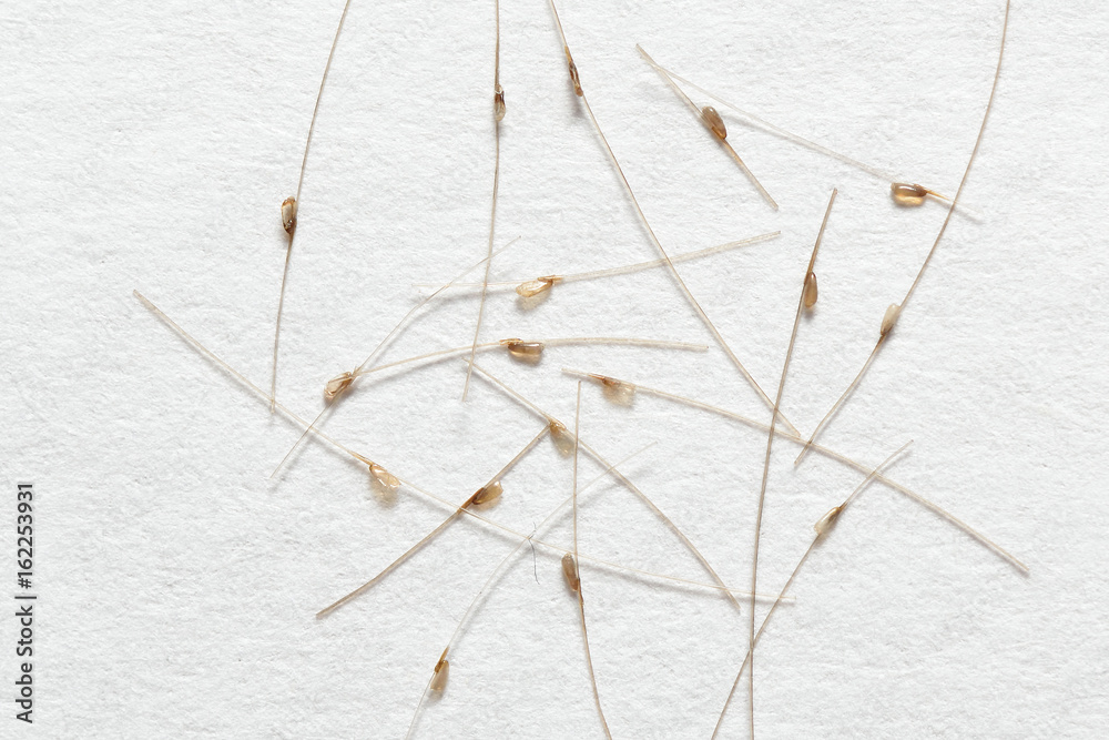 Nits on the hair, on white paper background Nits on the hair, on white paper background