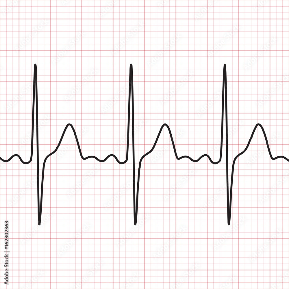Cardiogram. Electrocardiogram. Graphic representation of heart work . Health and medicine.