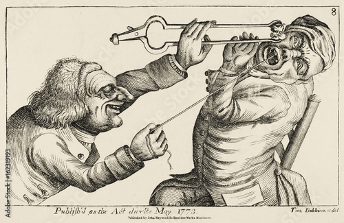 Принти на полотні Drawing a tooth with hot coal and string. Date: 1773