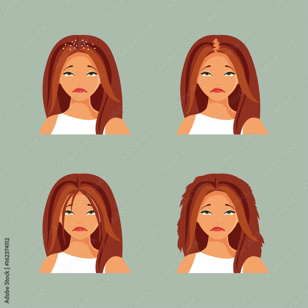 Hair problems Hair problems