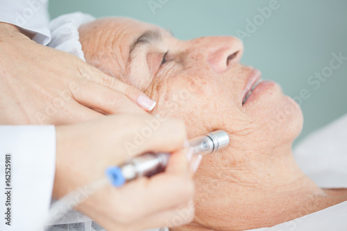 Microdermabrasion treatment on a senior woman face